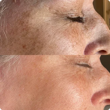 Masque Facial Exfoliant de Nuit