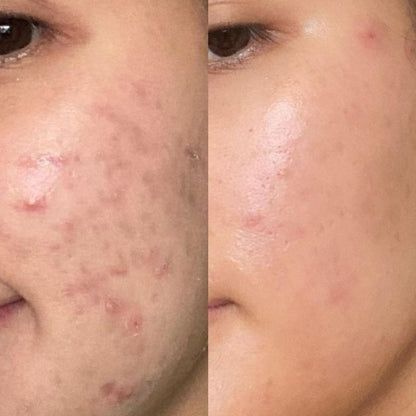 Masque Facial Exfoliant de Nuit