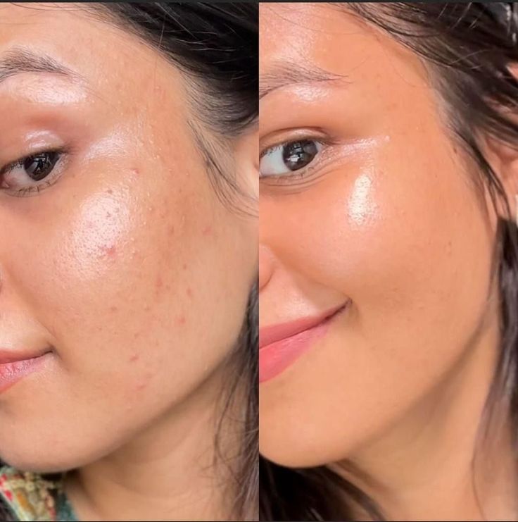 Masque Facial Exfoliant de Nuit
